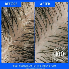 (6 pack) Head and Shoulders Dandruff Shampoo, Itchy Scalp Care, 12.5 fl oz